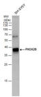 Paired Like Homeobox 2B antibody, GTX129908, GeneTex, Western Blot image 