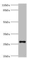 Tetraspanin 6 antibody, A61570-100, Epigentek, Western Blot image 