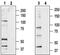 Transient Receptor Potential Cation Channel Subfamily V Member 2 antibody, PA5-77318, Invitrogen Antibodies, Western Blot image 