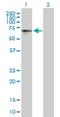 Prolyl 4-Hydroxylase, Transmembrane antibody, H00054681-B01P, Novus Biologicals, Western Blot image 