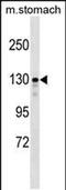 SLIT-ROBO Rho GTPase Activating Protein 1 antibody, PA5-48908, Invitrogen Antibodies, Western Blot image 