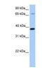 Hydroxymethylbilane Synthase antibody, NBP1-56412, Novus Biologicals, Western Blot image 