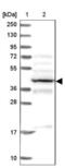 Proteasome 26S Subunit, ATPase 6 antibody, NBP2-13822, Novus Biologicals, Western Blot image 