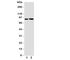 Fibroblast Growth Factor Receptor 3 antibody, R31262, NSJ Bioreagents, Western Blot image 