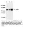 Damage Specific DNA Binding Protein 1 antibody, GTX70307, GeneTex, Western Blot image 