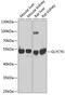 Glycerate Kinase antibody, GTX33222, GeneTex, Western Blot image 