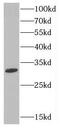 Nuclear LIM interactor-interacting factor 2 antibody, FNab02051, FineTest, Western Blot image 