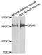 Glutamate Metabotropic Receptor 5 antibody, A9819, ABclonal Technology, Western Blot image 