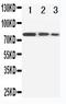 Endoglin antibody, PA1395, Boster Biological Technology, Western Blot image 