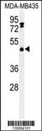 F-box/LRR-repeat protein 2 antibody, MBS9212225, MyBioSource, Western Blot image 