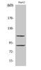 Zinc finger protein 148 antibody, STJ96299, St John