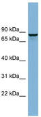 Golgi Associated, Gamma Adaptin Ear Containing, ARF Binding Protein 3 antibody, TA333540, Origene, Western Blot image 