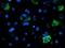 Acyl-CoA Synthetase Medium Chain Family Member 5 antibody, NBP2-01874, Novus Biologicals, Immunofluorescence image 