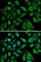 NFKB Inhibitor Beta antibody, LS-C334284, Lifespan Biosciences, Immunofluorescence image 