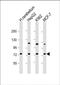 Sphingomyelin Phosphodiesterase 1 antibody, PA5-71659, Invitrogen Antibodies, Western Blot image 