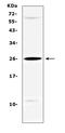 Sex Determining Region Y antibody, A00614-1, Boster Biological Technology, Western Blot image 