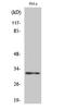 Androgen Induced 1 antibody, STJ91515, St John