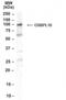 Oxysterol Binding Protein Like 10 antibody, NB100-2448, Novus Biologicals, Western Blot image 