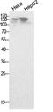 Nuclear Receptor Coactivator 3 antibody, A01337-2, Boster Biological Technology, Western Blot image 