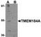 Transmembrane Protein 184A antibody, TA306957, Origene, Western Blot image 