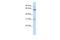 Intestine Specific Homeobox antibody, A13240, Boster Biological Technology, Western Blot image 