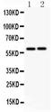 Lymphotoxin Beta Receptor antibody, LS-C313101, Lifespan Biosciences, Western Blot image 