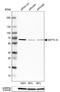 Methyltransferase Like 14 antibody, NBP1-81392, Novus Biologicals, Western Blot image 