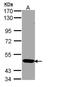 Serine/Threonine Kinase 33 antibody, PA5-28911, Invitrogen Antibodies, Western Blot image 