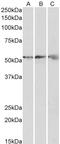 ATP Synthase F1 Subunit Beta antibody, LS-C305862, Lifespan Biosciences, Western Blot image 