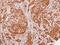 SEC13 Homolog, Nuclear Pore And COPII Coat Complex Component antibody, NBP1-33291, Novus Biologicals, Immunohistochemistry paraffin image 