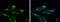 Adenylate Kinase 4 antibody, GTX104430, GeneTex, Immunofluorescence image 