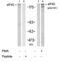 Eukaryotic Translation Initiation Factor 4 Gamma 1 antibody, GTX79087, GeneTex, Western Blot image 