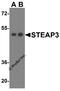 STEAP3 Metalloreductase antibody, A05568-1, Boster Biological Technology, Western Blot image 