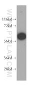 MAGE Family Member B18 antibody, 17494-1-AP, Proteintech Group, Western Blot image 