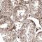 Potassium Channel Tetramerization Domain Containing 13 antibody, PA5-60403, Invitrogen Antibodies, Immunohistochemistry frozen image 