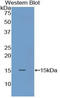 S100 Calcium Binding Protein A9 antibody, LS-C300843, Lifespan Biosciences, Western Blot image 