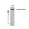 TSC Complex Subunit 2 antibody, LS-C381573, Lifespan Biosciences, Western Blot image 