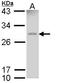 Glutathione S-Transferase Mu 1 antibody, LS-B4796, Lifespan Biosciences, Western Blot image 