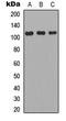 Apolipoprotein B Receptor antibody, LS-C354277, Lifespan Biosciences, Western Blot image 
