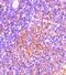 TRAF family member-associated NF-kappa-B activator antibody, GTX31740, GeneTex, Immunohistochemistry paraffin image 