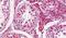 Adhesion G Protein-Coupled Receptor G2 antibody, PA5-33751, Invitrogen Antibodies, Immunohistochemistry paraffin image 