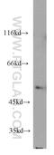 Eukaryotic Translation Initiation Factor 2 Subunit Gamma antibody, 11162-1-AP, Proteintech Group, Western Blot image 
