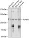 Transforming Growth Factor Beta Receptor 3 antibody, 13-224, ProSci, Western Blot image 