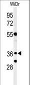 NSE4 Homolog A, SMC5-SMC6 Complex Component antibody, LS-C163020, Lifespan Biosciences, Western Blot image 