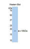 ADAM Metallopeptidase With Thrombospondin Type 1 Motif 1 antibody, LS-C298524, Lifespan Biosciences, Western Blot image 