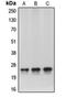 Chromobox 5 antibody, orb215085, Biorbyt, Western Blot image 