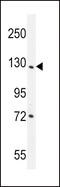 DExD/H-Box 60 Like antibody, 55-936, ProSci, Western Blot image 