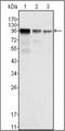 FER Tyrosine Kinase antibody, orb88957, Biorbyt, Western Blot image 
