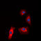 Insulin Like Growth Factor 1 Receptor antibody, LS-C358783, Lifespan Biosciences, Immunofluorescence image 