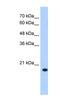 DCTP Pyrophosphatase 1 antibody, NBP1-55335, Novus Biologicals, Western Blot image 